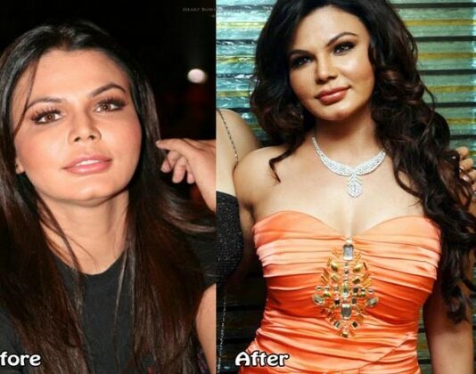 Bollywood Actresses Whose Plastic Surgeries Have Gone Wrong Rakhi Sawant