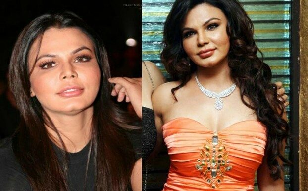 Bollywood Actresses Whose Plastic Surgeries Have Gone Wrong Rakhi Sawant